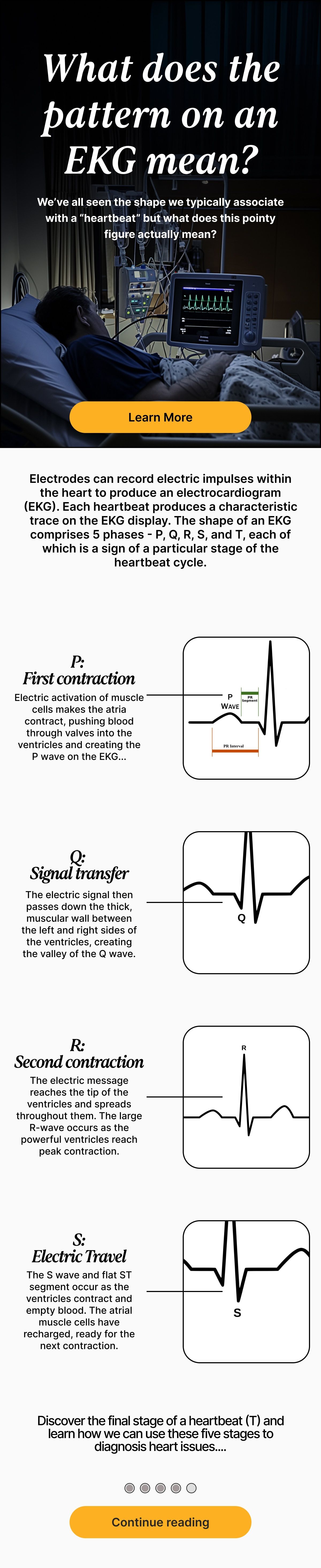 ekg-explained-what-does-each-wave-mean-umzu